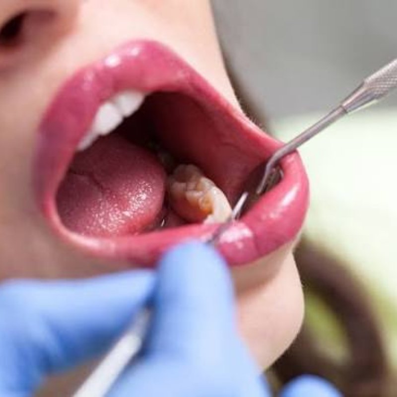 Biopsy & Diagnosis in Bhagalpur
