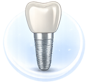 Dental implants treatment in Bhagalpur