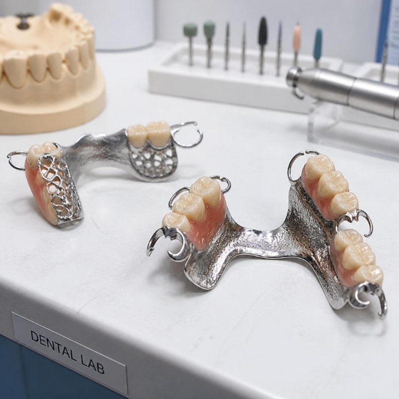 Cast Partial Dentures in Bhagalpur
