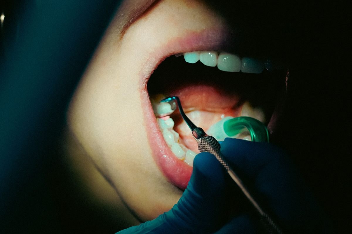 Oral cancer diagnosis and surgery in Bhagalpur
