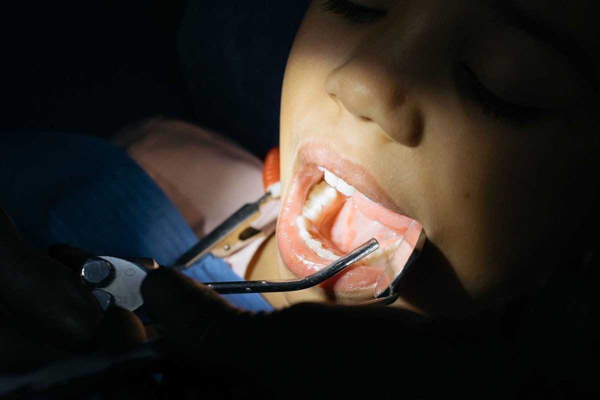 Jaw and face tumour removal surgery in Bhagalpur