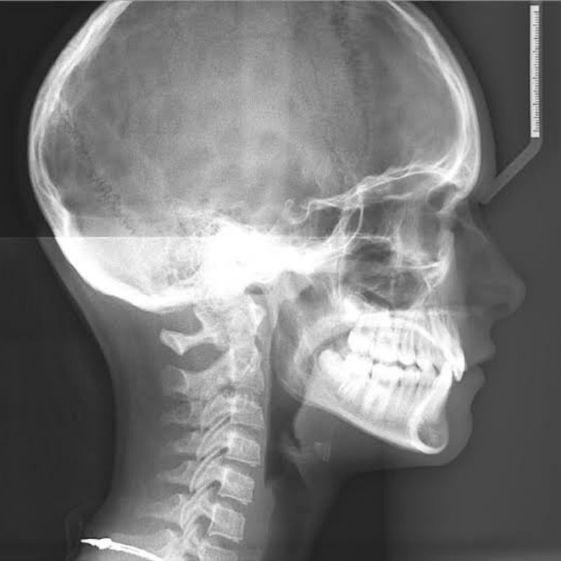 Diagnostic Imaging in Bhagalpur