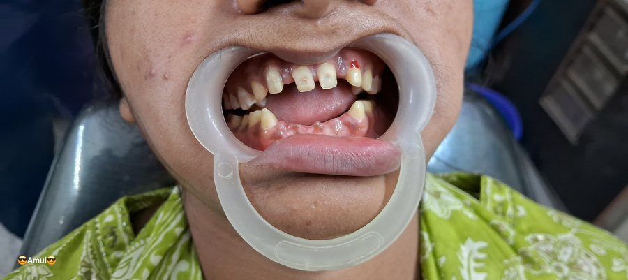 Before dental treatment