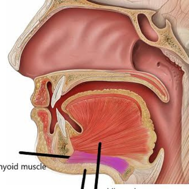 Ludwig's Angina in Bhagalpur