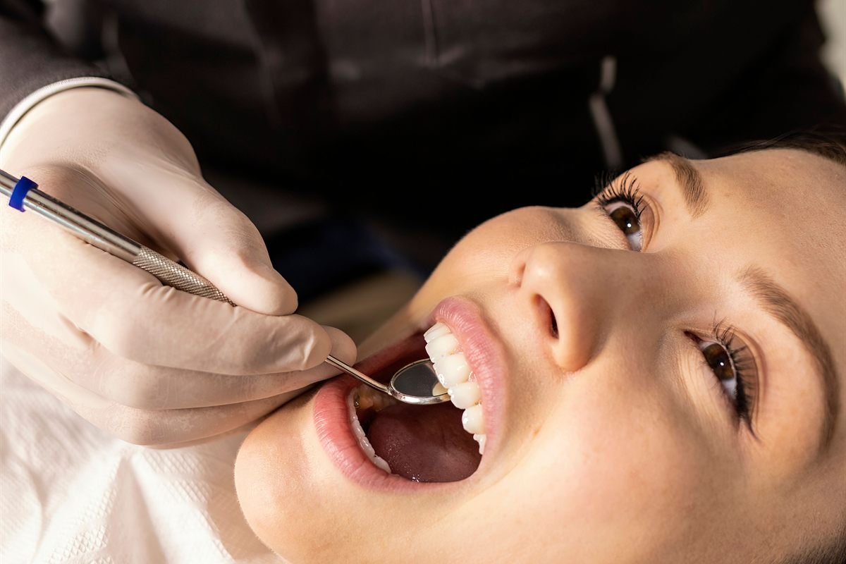 Teeth cleaning and scaling in Bhagalpur