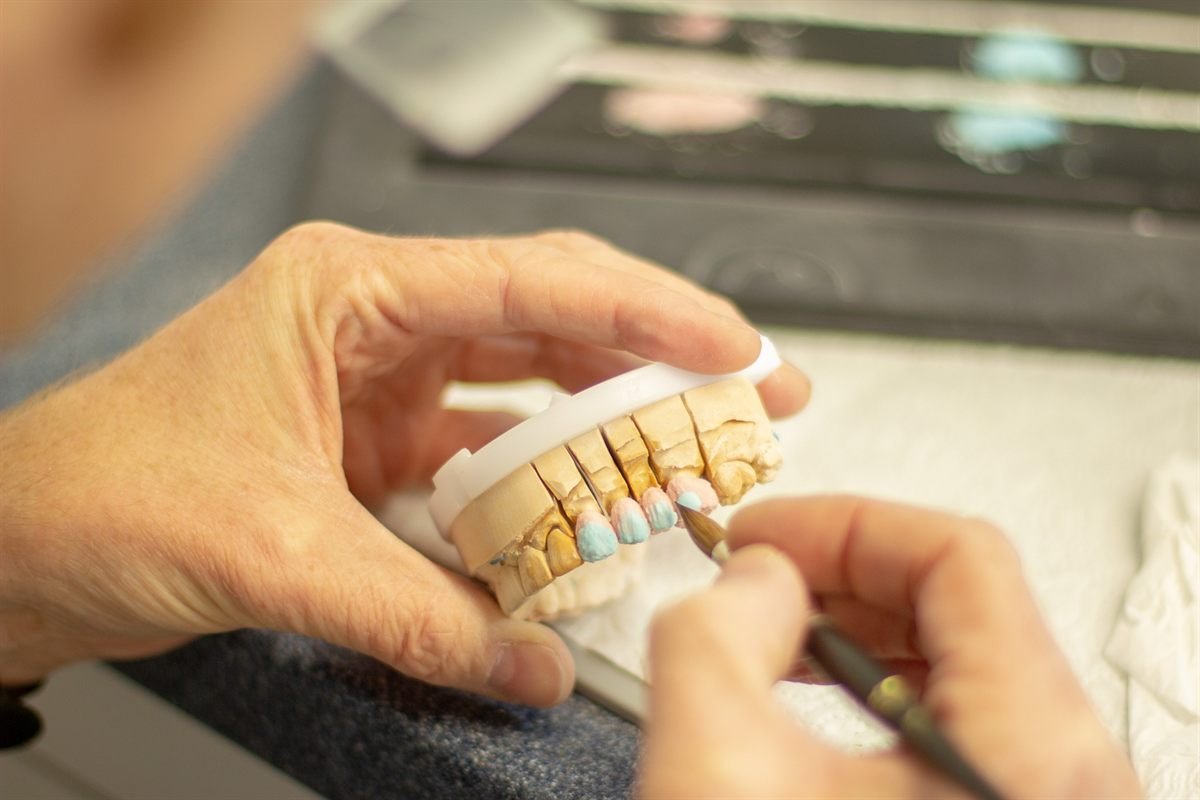 Dentures and dental prosthetics in Bhagalpur