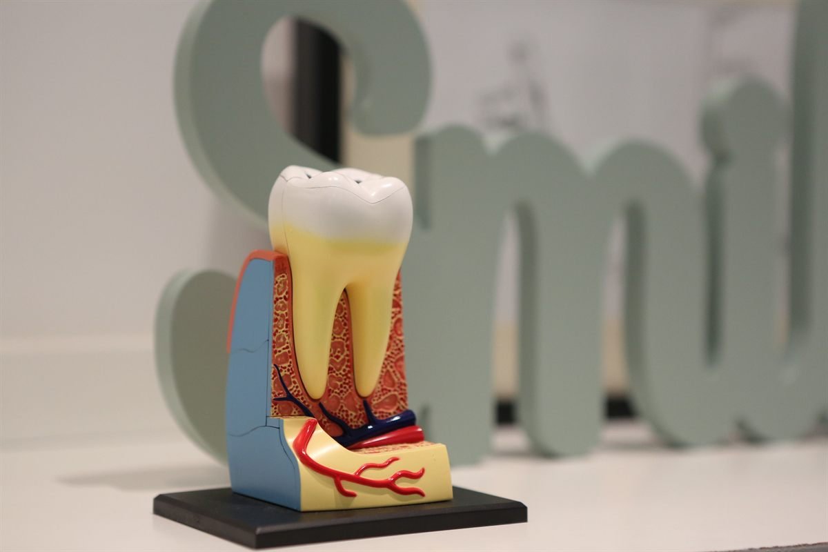 Dental fillings and root canal treatment in Bhagalpur