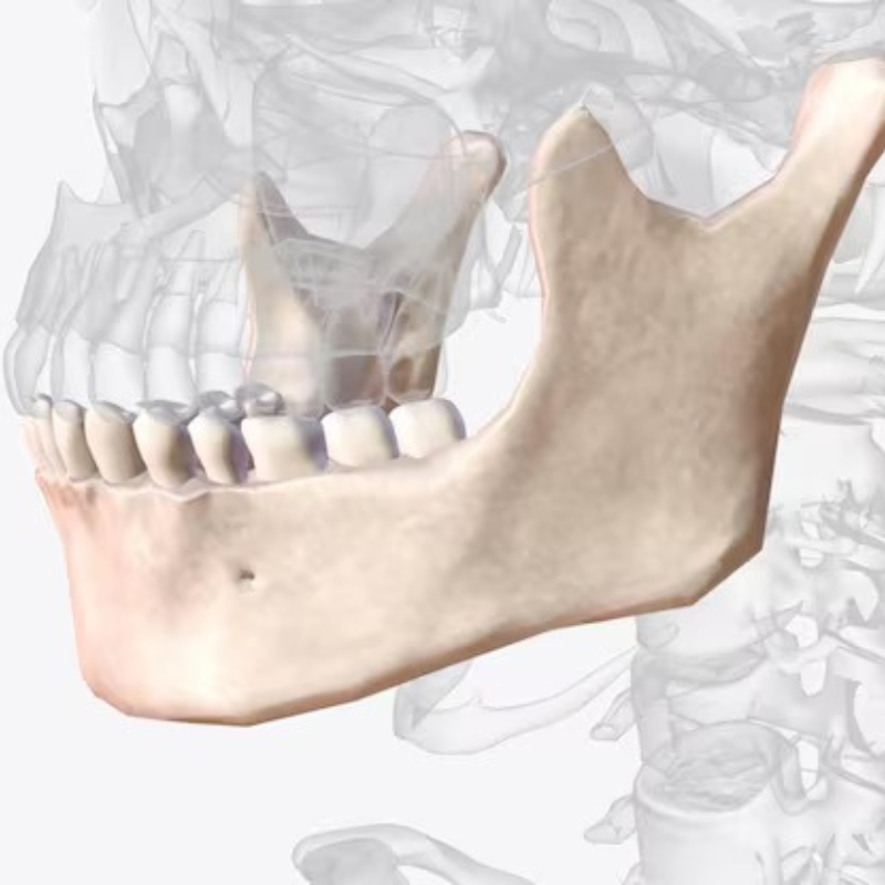Gap Arthroplasty in Bhagalpur