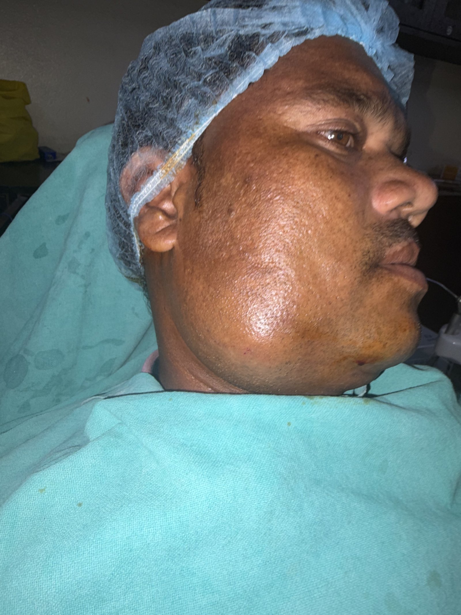 Facial swelling before surgery