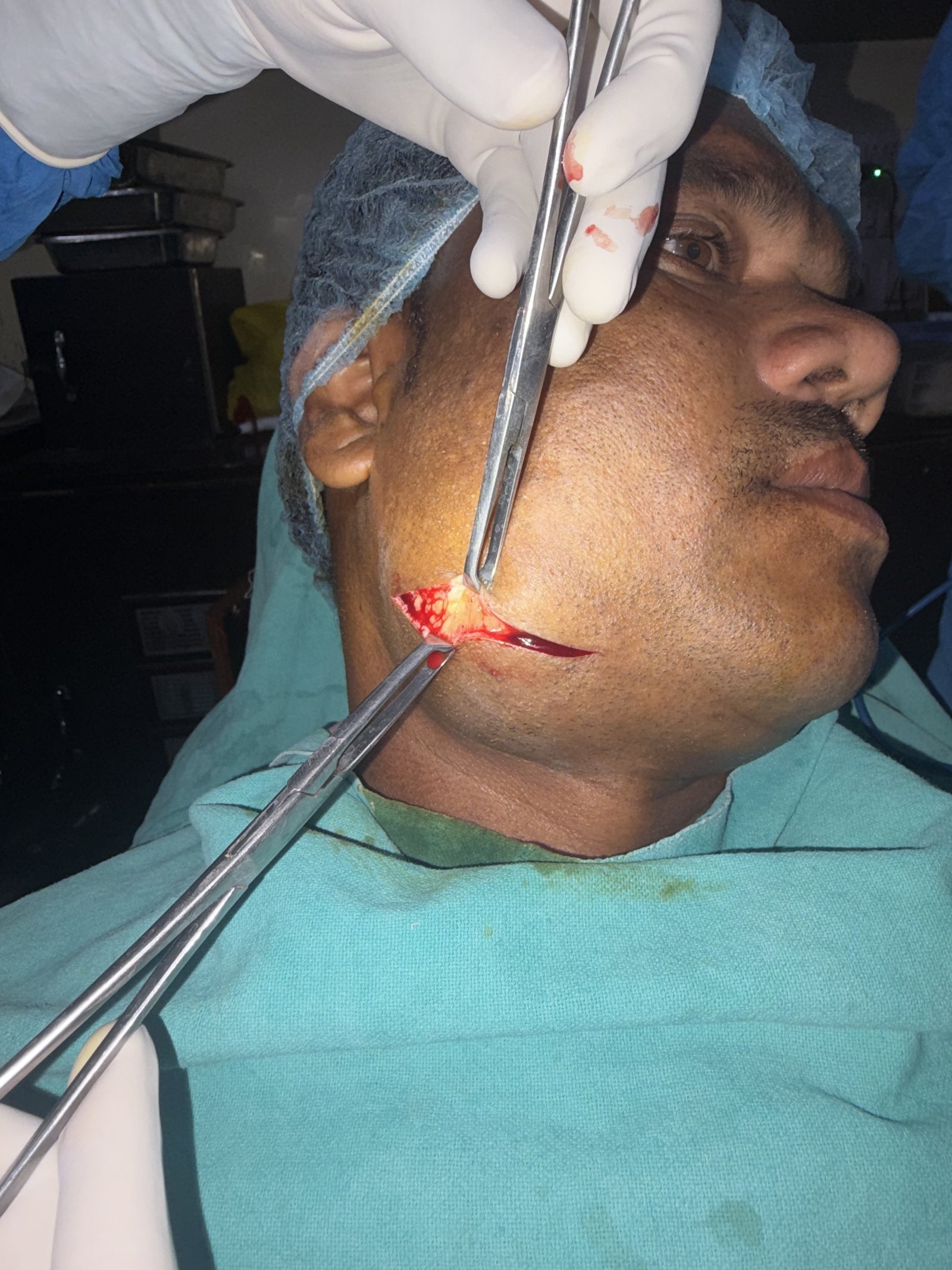 Surgical incision