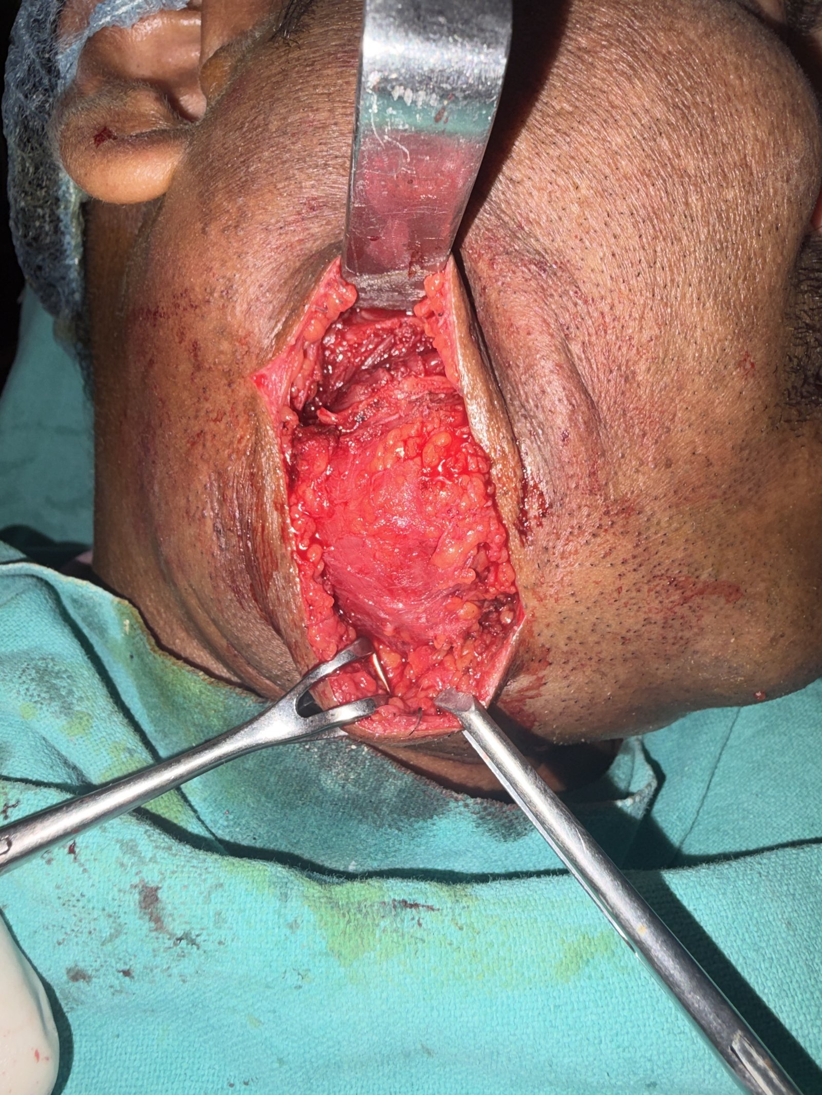 Surgical site